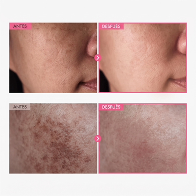 Crema Coreana Avanzada de Arbutina Aclaradora