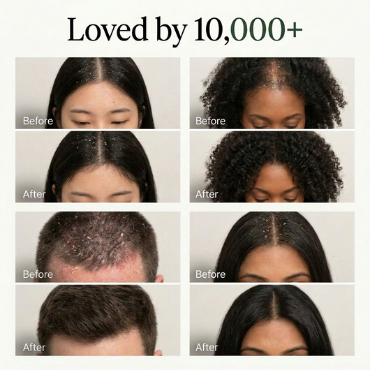 Korean Scalp Relief Bar